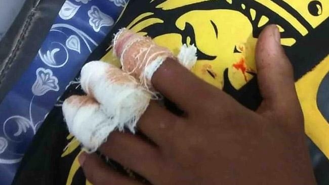 school student injured while making crackers