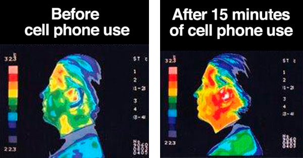 cell phones causing cancer