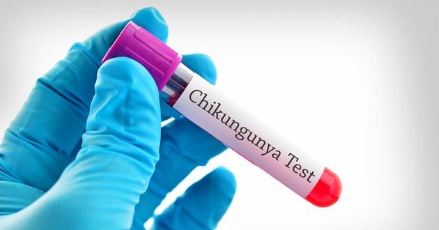 chikungunya test