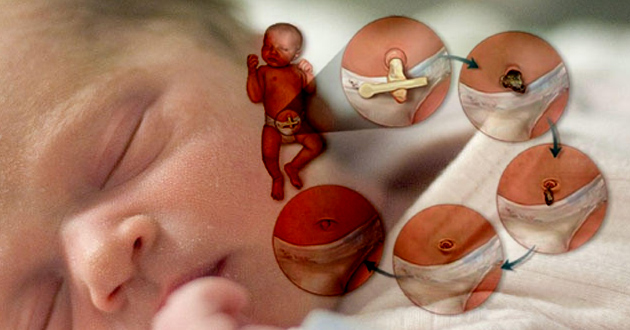 new born baby nebel care