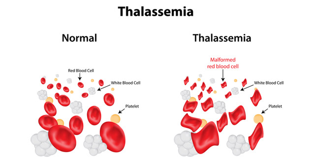 thalassemia red blood cells
