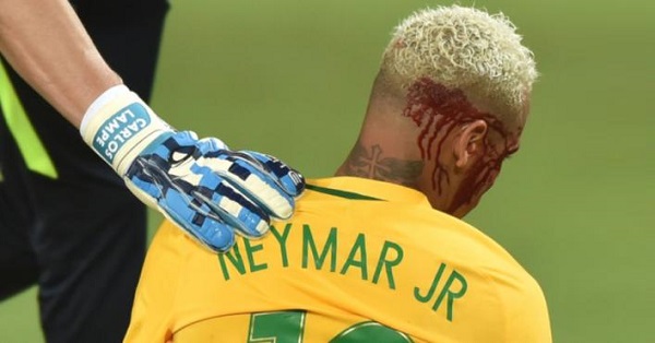 Neymar of Brazil against bolivia injured