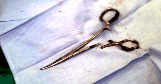pair of scissors which was removed from a patient s abdomen