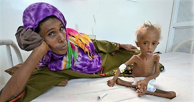 yemen airstrike children one