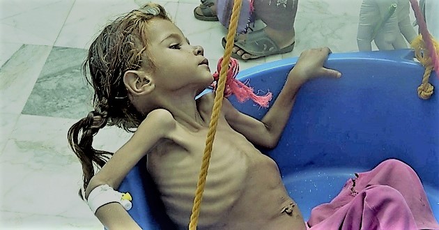 yemen child