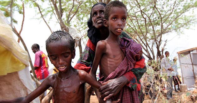 yemen children famine01