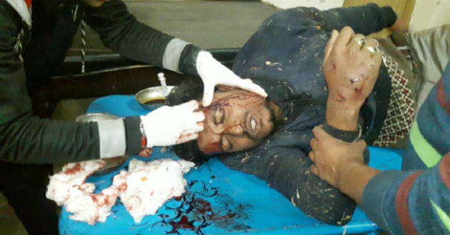  attack in chuadanga