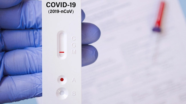 antigen test cov 19 bd