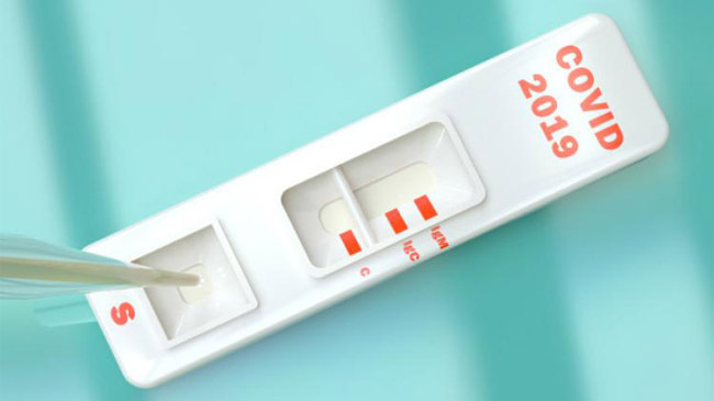 antigen test