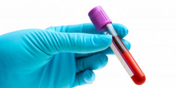 blood test sign