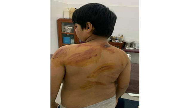 child tortured capital