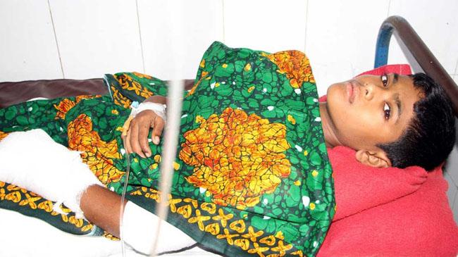 children burn in ctg 2