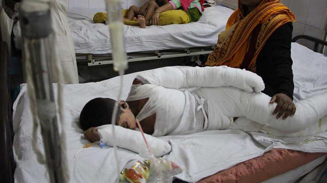 children burn in ctg
