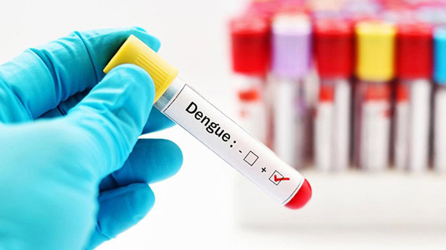 dengue test kit