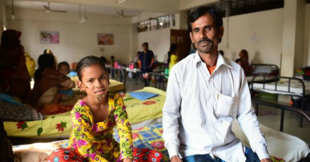 first women with tree man syndrome in bangladesh