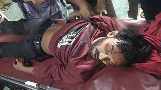 injured al bnp clash in gopibag