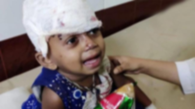 injured child