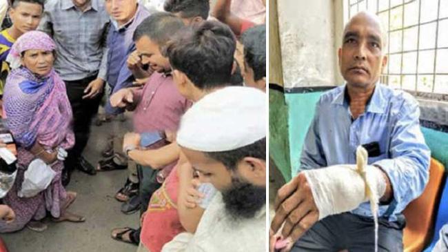 injured to buy onion