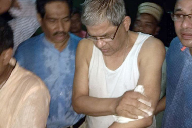 mirza fakhrul islam alamgir attacked in chittgaong