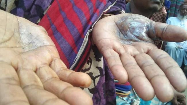 one miracle after another 1