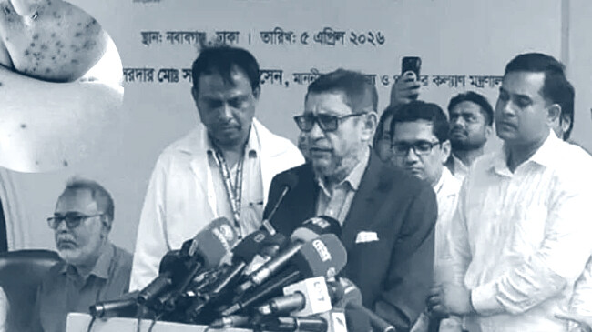 দেশব্যাপী হামের প্রতিষেধক প্রদান শুরু হচ্ছে ৩ মে