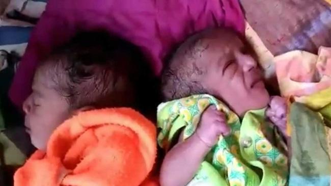 twin baby birth