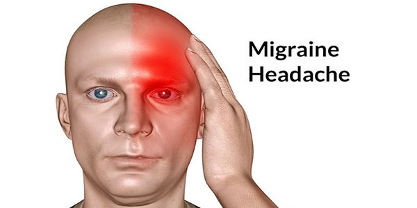 Migraine