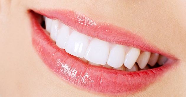 Whiten Teeth