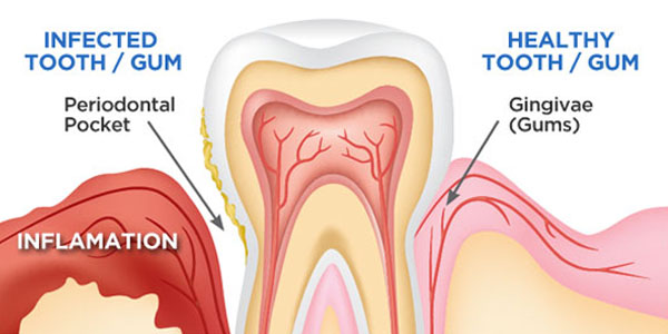 dental gum problems