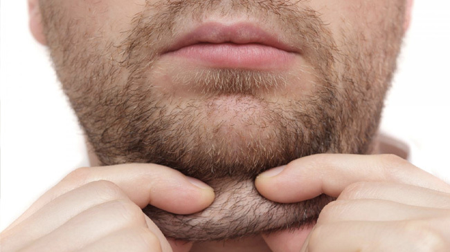 get rid of fat under the chin easily