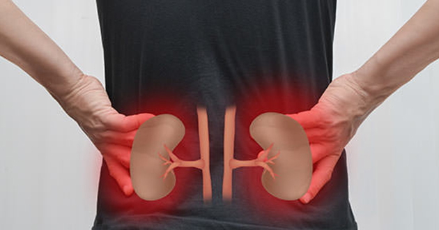 kidney disease