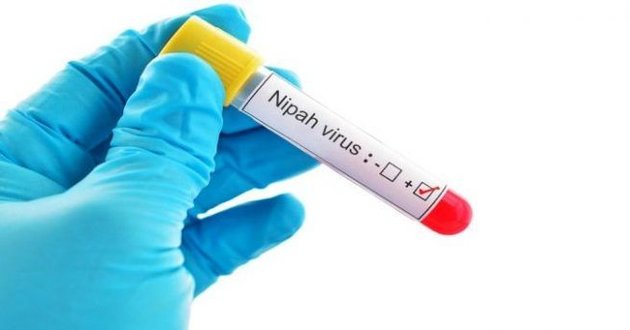 nipah virus