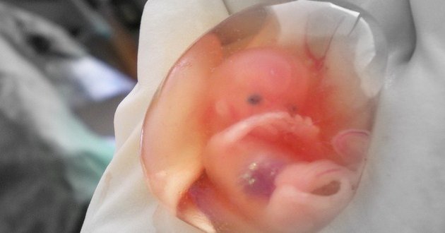 reason of miscarriage