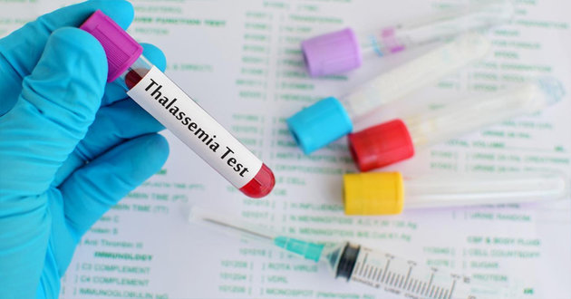 thalassemia