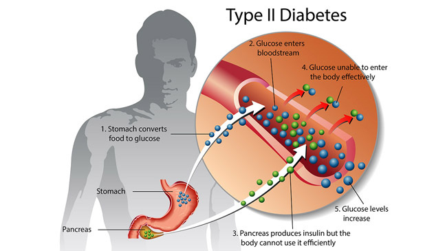 type 2 daiabetes