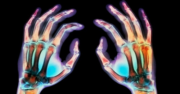 three d color x ray