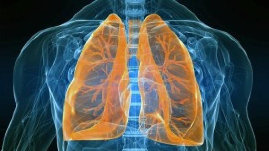 ফুসফুসের গুরুতর রোগে আক্রান্তদের জন্য সুখবর, এলো প্রথম চিকিৎসা