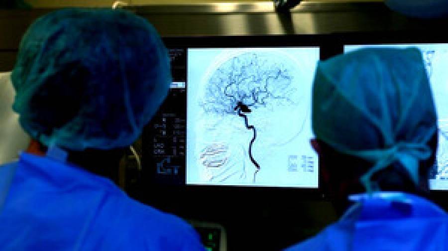 নতুন গবেষণা: মস্তিষ্কের ‘ছোট’ অংশের সঙ্গে সিজোফ্রেনিয়ার সংযোগ