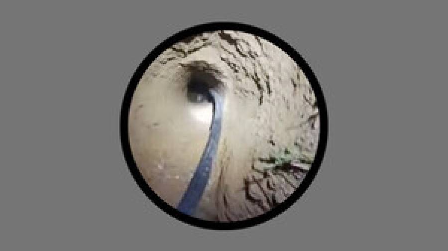 চট্টগ্রামে নলকূপের গর্তে পড়ে গেছে ৩ বছরের শিশু