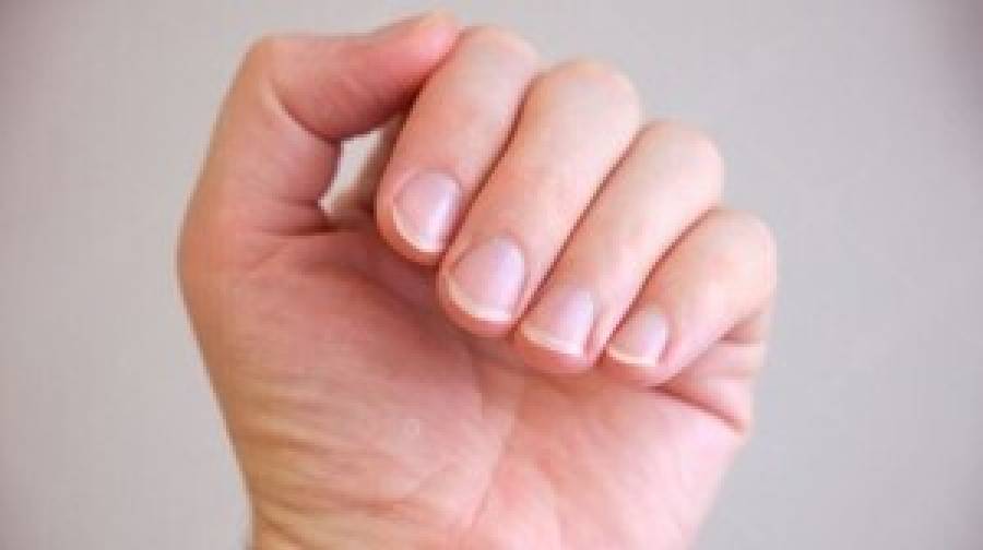 নখের রঙ ও গঠনে লুকিয়ে আছে নানা রোগের সংকেত!