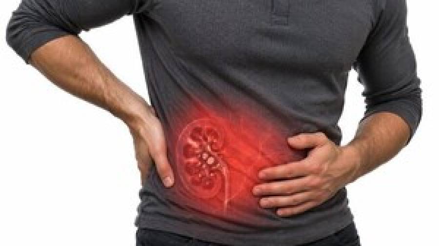 কিডনিতে পাথর হওয়ার কারণ ও প্রতিরোধের উপায়