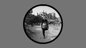 ইসরায়েলি নিষেধাজ্ঞায় গাজায় কৃত্রিম অঙ্গের সংকটে হাজারো যুদ্ধাহত