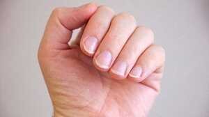 নখের রঙ ও গঠনে লুকিয়ে আছে নানা রোগের সংকেত!