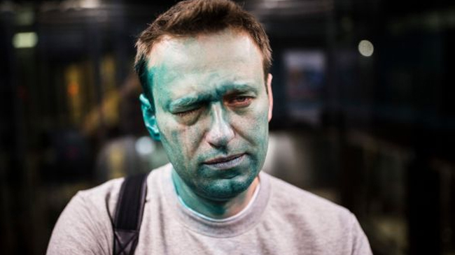alexei navalny injured