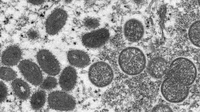 an electron microscope image of monkeypox