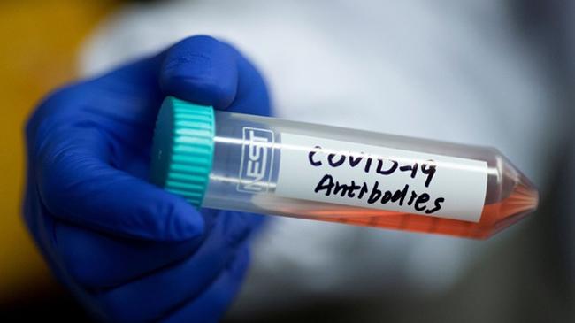 antibody test usa
