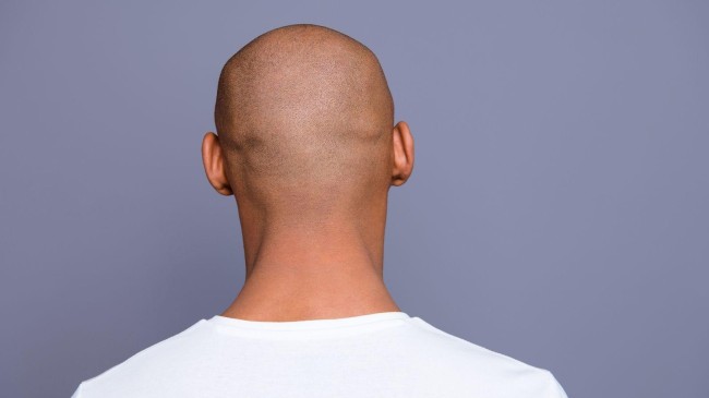 bald