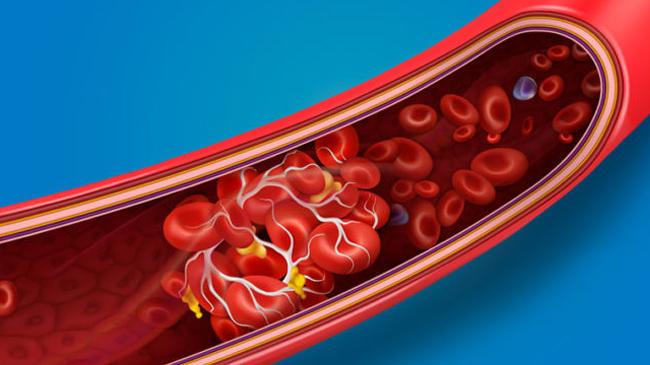blood cot symbolic picture