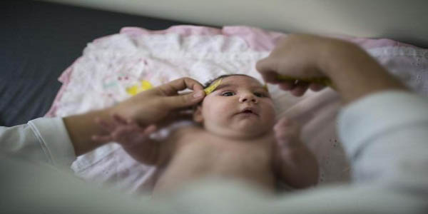 brazil zika birth defects