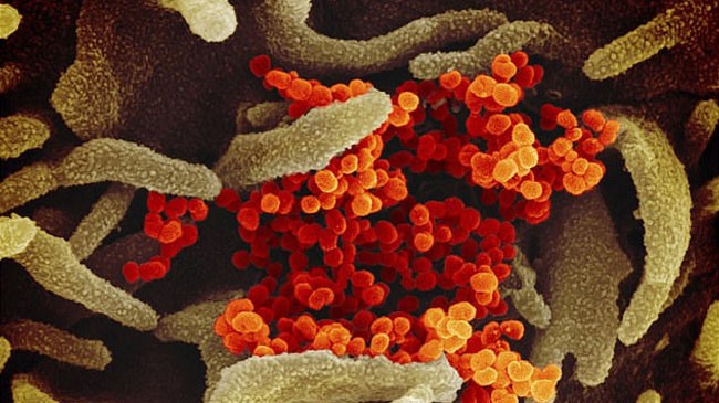 covid 19 virus image